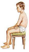 Fig. 41b - La iperlordosi scompare quando il bambino si mette seduto.